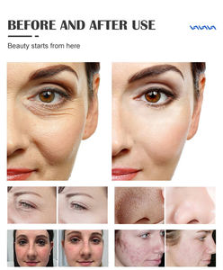 Machine d'hydrodermabrasion 17 en 1, machine de beauté faciale, machine de nettoyage de la peau à bulles fines pour salon de beauté - Product Image 5