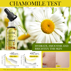 SADOER Productos para el cuidado de la piel Aceite esencial de plantas <span class=keywords><strong>Romero</strong></span> Rosa Lavanda Manzanilla Flor seca Aceite de masaje nutritivo multiefecto - Product Image 4