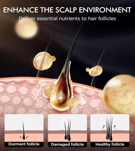 Champú sin sulfatos MELAO 60% Biotina, champú y tratamiento de alta potencia para soluciones de cabello fino, champú con aceite de cebolla. - Product Image 3