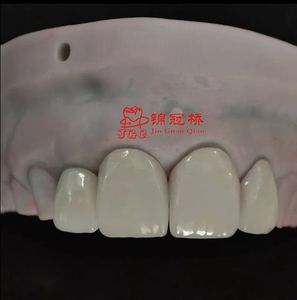 Dentaduras postizas totalmente cerámicas Zirconia o dentaduras postizas Pfm Tipos de Diseño Digital en <span class=keywords><strong>Exocad</strong></span> Rápido y eficiente - Product Image 1