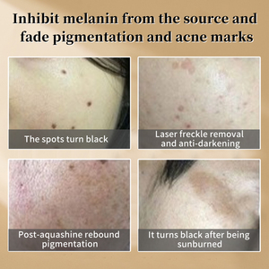 Crème de Nuit Traitante Anti-Hyperpigmentation Post-Inflammatoire pour Tous Types de Peau – Éclat du <span class=keywords><strong>Visage</strong></span> - Product Image 3