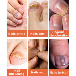 Lanthome-tratamiento puro orgánico natural, esencia <span class=keywords><strong>de</strong></span> suero nutritivo para el cuidado <span class=keywords><strong>de</strong></span> las <span class=keywords><strong>uñas</strong></span>, antihongos, suaves e hidratantes - Product Image 5