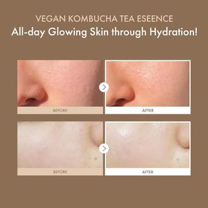 Essence <span class=keywords><strong>de</strong></span> thé <span class=keywords><strong>de</strong></span> kombucha végétalien tout-en-un avec extrait <span class=keywords><strong>de</strong></span> thé 78% Éclaircir la <span class=keywords><strong>peau</strong></span> Nettoyage en profondeur des pores Logo personnalisé Sérum <span class=keywords><strong>de</strong></span> soin <span class=keywords><strong>de</strong></span> la <span class=keywords><strong>peau</strong></span> coréen - Product Image 3