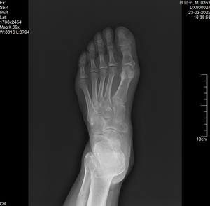 كاشف لوحي مسطح محمول عالي الدقة جديد لعام <span class=keywords><strong>2026</strong></span> - Product Image 6