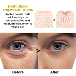<span class=keywords><strong>Meilleur</strong></span> Sérum Visage au Collagène et Acide Hyaluronique, Soin Corporel Liquide, Sans Parabène, Hydratant, Éclaircissant, Anti-Âge, Anti-Rides, au Thé Vert - Product Image 5