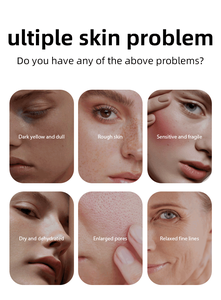 MOIKA Vente en gros de <span class=keywords><strong>masque</strong></span> de beauté au miel pour le visage <span class=keywords><strong>Masque</strong></span> hydratant pour les soins de la peau - Product Image 2