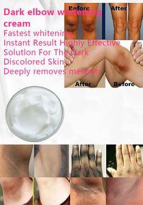 Crème corporelle hydratante en profondeur, blanchissante et réparatrice, à l'urée, adoucissante <span class=keywords><strong>pour</strong></span> <span class=keywords><strong>les</strong></span> <span class=keywords><strong>pieds</strong></span> et <span class=keywords><strong>les</strong></span> genoux, cosmétiques professionnels OEM - Product Image 2