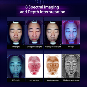Analizzatore Cutaneo AI Professionale per Acne, Scanner Facciale 3D con Rilevamento AI per Uso Domestico e Commerciale - Product Image 3