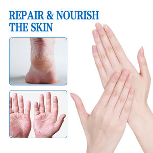 Stick hydratant pour les mains et les pieds, hydratation intense, apaise les talons fissurés, baume réparateur pour les pieds - Product Image 2
