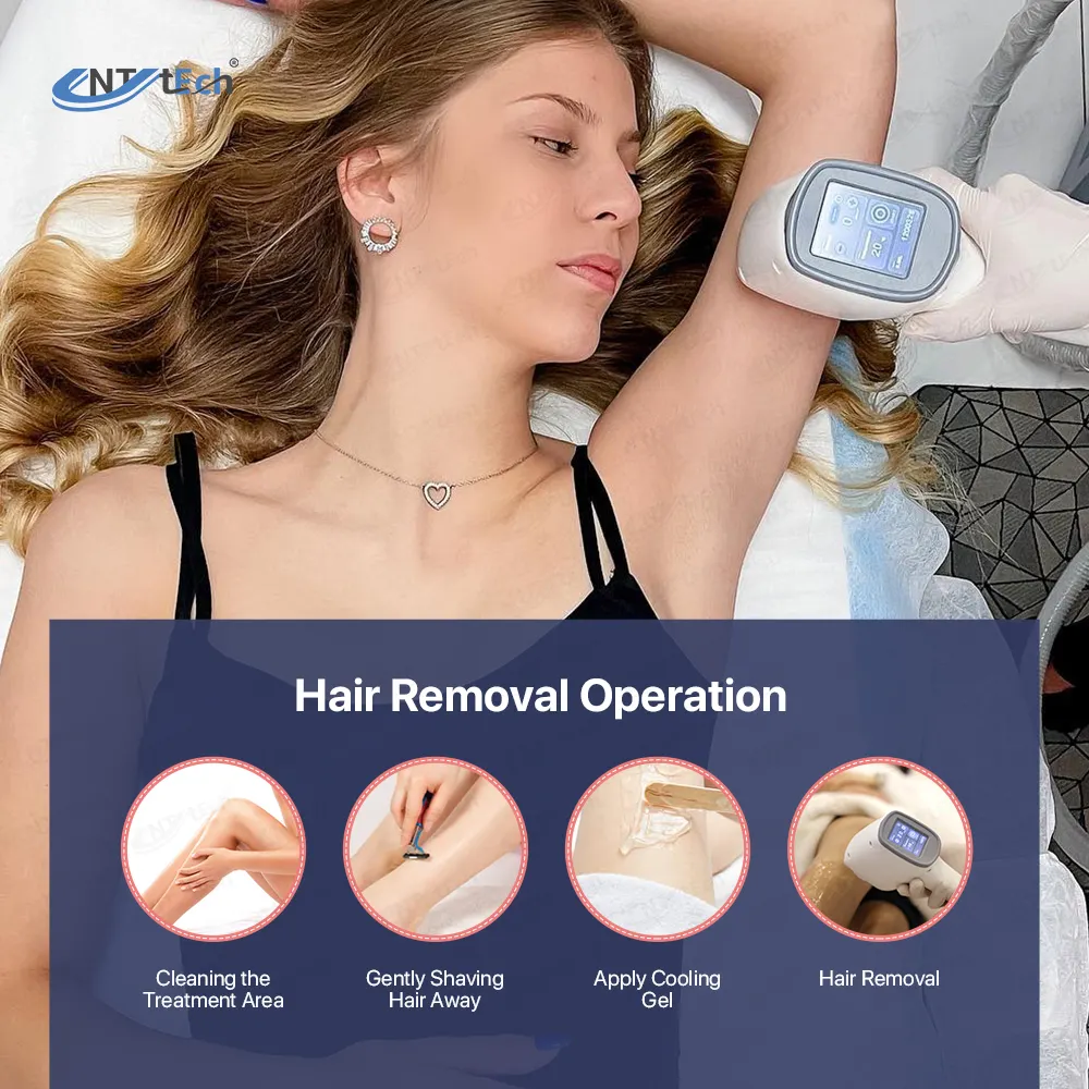 Laser Hair Removal Exclusive Android Trio Diode Machine Laser Hair Removal Women For Body And Face