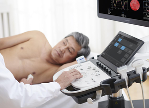 Ecógrafo Sonoscape P12 Elite, Máquina de Ultrasonido, Instrumentos Médicos de Ultrasonido para Hospitales - Product Image 3