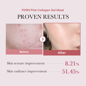 <span class=keywords><strong>Masque</strong></span> en gel hydrogel au collagène rose PDRN OEM pour la peau, anti-âge, liftant, raffermissant, hydratant - Product Image 4