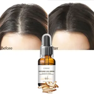 Предотвращает выпадение волос и помогает волосам гуще, сильнее, длиннее, для лечения волос, терапия кожи головы, восстанавливающий сыворотку кожи головы
