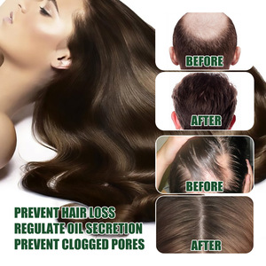 Regrow 7 Day Jengibre <span class=keywords><strong>Germinal</strong></span> Serum Nutritivo Masaje del Cuero Cabelludo Raíces Cuidado Esencia 30ML 1 FlOz Jengibre Crecimiento del Cabello Aceite <span class=keywords><strong>Germinal</strong></span> - Product Image 3