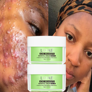 Kit de Creme Diurno OEM&ODM para Remoção de Acne e Manchas Escuras com Colágeno e Glicerina para Pele Sensível - Product Image 1