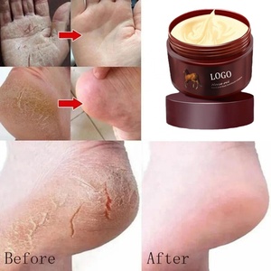 Crema Humectante para Manos y Pies con Aceite de Caballo, Diseño Personalizado, Marca Privada, para Reparación de Talones Agrietados - Product Image 4