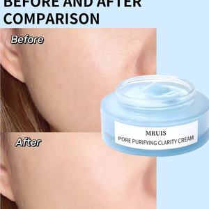 <span class=keywords><strong>Crema</strong></span> Facial Vegana Orgánica de Etiqueta Privada con Aceite de Tanaceto Azul de 30g - <span class=keywords><strong>Crema</strong></span> de Belleza Equilibrante Antiarrugas y Purificante de Poros al por Mayor - Product Image 3