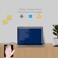 Escáner de venas de Palma portátil HFSecurity de alta calidad MP30 Android SDK gratis listo para pago o control de acceso