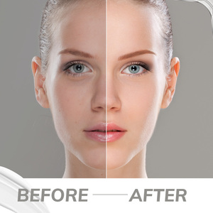 <span class=keywords><strong>Crema</strong></span> Idratante Naturale all'Olio di Cocco per <span class=keywords><strong>Viso</strong></span> e Corpo, Schiarente e Nutriente, Etichetta Privata, 250g - Product Image 6