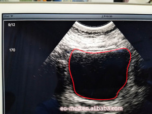 Scanner de vessie à ultrasons sans fil à haute vitesse (2s), mini scanner portatif 4d B10 - Product Image 5