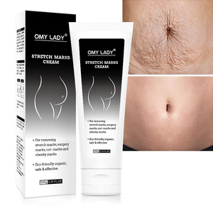 Fórmula herbal natural omy Lady, eliminador permanente de cicatrices de acné, crema antiestrías, personalizado gratis - Product Image 1
