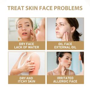 Cosmétique Halal, marque privée, soin de la peau coréen, éclaircissant, blanchissant, hydratant, tonique pour le visage à la nicotinamide et à l'eau de riz - Product Image 3