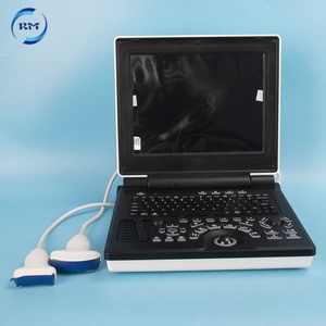 Appareil d'échographie couleur portable haute <span class=keywords><strong>définition</strong></span> multi-mode à 80 éléments avec double prise de sonde - Product Image 2