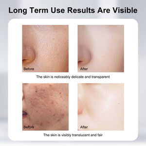 Serovar Shilajit per viso liquido crema idratante siero per tutti i tipi di pelle acqua-reintegro - Product Image 5