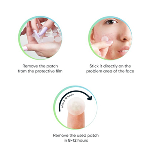 Cubierta absorbente Punto de imperfecciones para zits imperfecciones puntos blancos hidrocoloide Acné Parche de espinillas - Product Image 5