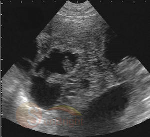 Échographe vétérinaire portable de haute qualité, scanner à ultrasons pour le poignet et la paume - Product Image 3