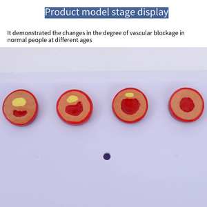 Model Anatomi Arteri Koronari Patologis Manusia Model Ilmu Kedokteran PVC Model Aterosklerosis - Product Image 2