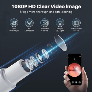Dispositif d'aspiration des calculs amygdaliens avec caméra HD, enregistrement photo et vidéo grand angle 360°, rechargeable, nettoyeur buccal pour mauvaise haleine - Product Image 5