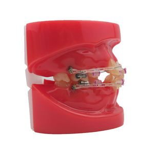 Modelo de Demostración de Ortodoncia Dental con 24 Piezas de Brackets de Cerámica - Product Image 3