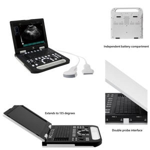 Resolusi Tinggi Tinggi terpasang 3D 4D warna <span class=keywords><strong>Doppler</strong></span> 15 inci Ecografo portatel PW <span class=keywords><strong>CW</strong></span> jantung gema mesin Ultrasound - Product Image 2