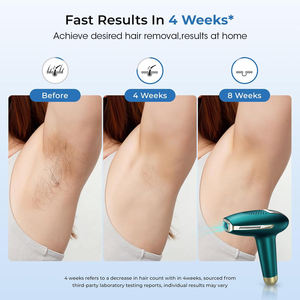 Appareil d'<span class=keywords><strong>épilation</strong></span> au laser IPL saphir de <span class=keywords><strong>la</strong></span> marque Deess pour femmes et hommes, appareil d'<span class=keywords><strong>épilation</strong></span> permanente <span class=keywords><strong>à</strong></span> domicile - Product Image 2