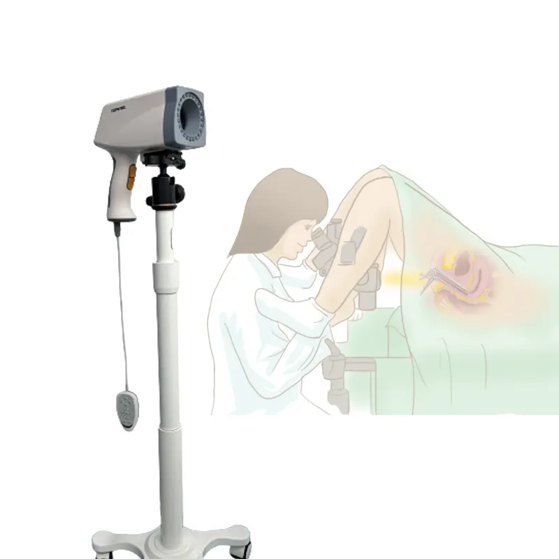 Sistema de imagen de colposcopio Digital CE Kernel de fábrica, colposcopio de examen vaginal para máquina de colposcopio de ginecología