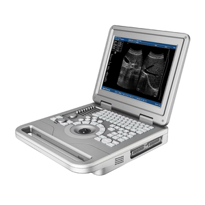 New Design <strong>Laptop</strong> <strong>Ultrasound</strong> Machine Hot Sale Hospital <strong>Ultrasound</strong> Machine Black and White <strong>Color</strong> <strong>Ultrasound</strong> Scanner - Product Image 6