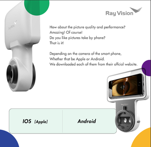 Sistema de Imagenología de Lámpara de Hendidura Inteligente de Alta Compatibilidad, Sin Necesidad de <span class=keywords><strong>PC</strong></span>, Compatible con Dispositivos Móviles <span class=keywords><strong>para</strong></span> Revisión Ocular - Product Image 5