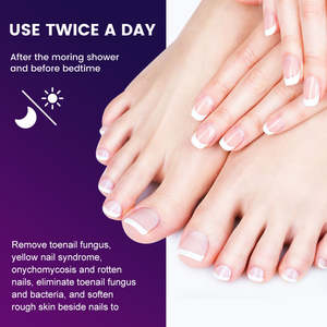 Kräuter salbe zur Behandlung von Nagel pilzen Fußpflege zur Pilz entfernung von Zehennägeln Gesundheits versorgung - Product Image 4