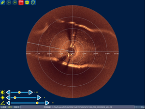 SV1006 Tri-frequentie 2D-scanning <span class=keywords><strong>sonar</strong></span> 400kHz-1,1MHz titaniumlegering voor 360° detectie, botsingspreventie & pijpprofileren - Product Image 3