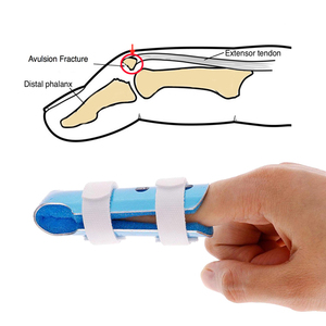 אצבע סד אגודל אצבעות סד תמיכת פגיעה הגנת כיפוף עיוות יציבה תיקון כאב הקלה יד אורתופדיה - Product Image 5