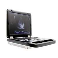CONTEC - CMS1700C Portable Ultrasonic Machine