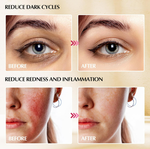 Globes faciaux <span class=keywords><strong>de</strong></span> bâtons <span class=keywords><strong>de</strong></span> Cryo, globes <span class=keywords><strong>de</strong></span> <span class=keywords><strong>glace</strong></span> d'acier inoxydable - Product Image 5