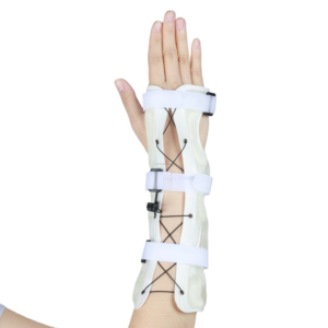 Nuevo inmovilizador de muñeca ortopédico de inyección de polímero fotopolimerizable 2026 para fijación de muñeca y recuperación de fracturas - Product Image 3