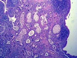 निर्माता मानव पैथोलॉजी अनुभाग स्लाइड 100 मानव स्थानीय सूजन माइक्रोस्कोप उपकरण के टुकड़ों का उत्पादन करते हैं - Product Image 5