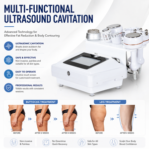 Appareil esthétique commercial de cavitation 40K avec technologie à double fréquence pour les centres de bien-être et de spa - Product Image 1
