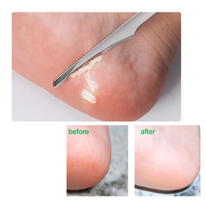 KODIES GEL Cuticula Remover Voet Exfoliërende <span class=keywords><strong>Callus</strong></span> en Cuticula Softener Verwijderaar Vloeistof 150ML Big Size Private Label/Custom Logo - Product Image 4