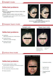 Portable 3D beauté visage analyseur <span class=keywords><strong>de</strong></span> <span class=keywords><strong>peau</strong></span> usage domestique Salon Machines Test dispositif vente <span class=keywords><strong>prix</strong></span> sur soins du visage équipement d'analyse <span class=keywords><strong>de</strong></span> la <span class=keywords><strong>peau</strong></span> - Product Image 6