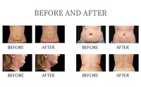 2023 vertical 10 en 1 lipo laser lipocavitation lipo rf 80k cavitation minceur machine système de cavitation dispositif de vide