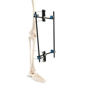 Fixator eksternal medis ringan dengan batang serat karbon 11mm * 500mm batang penghubung - Product Image 3